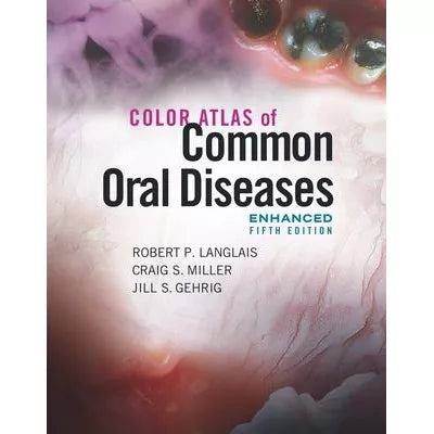 Color Atlas of Common Oral Diseases, Enhanced Edition